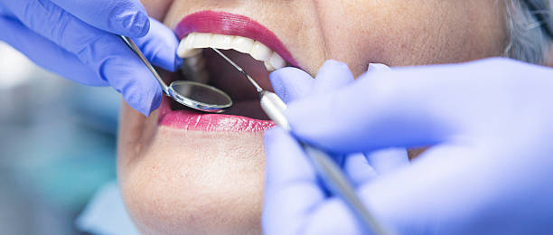 Best Emergency Dentist for Knocked-Out Tooth in Fitchburg, MA